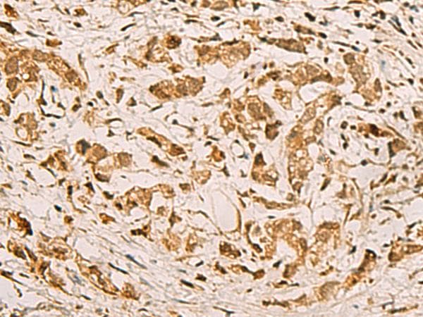 ZMAT4 Antibody