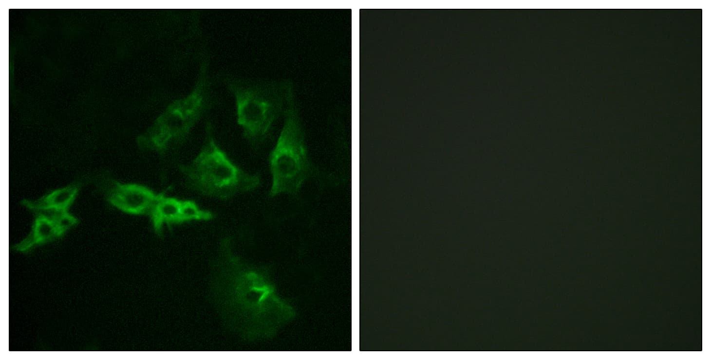 GnRH receptor / GNRHR Antibody (aa41-90)