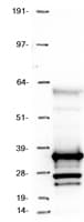SKAP / HSD11 Protein (Over-Expression Lysate Myc-DDK (Flag))
