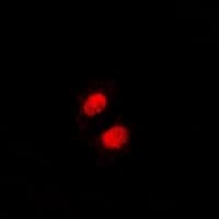 FACT / SSRP1 Antibody