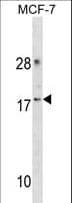 CDK2AP2 Antibody (aa64-92)
