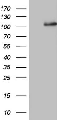 NCAM / CD56 Antibody (aa20-718, clone OTI2C3)
