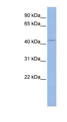 Polyclonal Rabbit anti-Human KCNJ5 / Kir3.4 / GIRK4 Antibody (N-Terminus, WB)