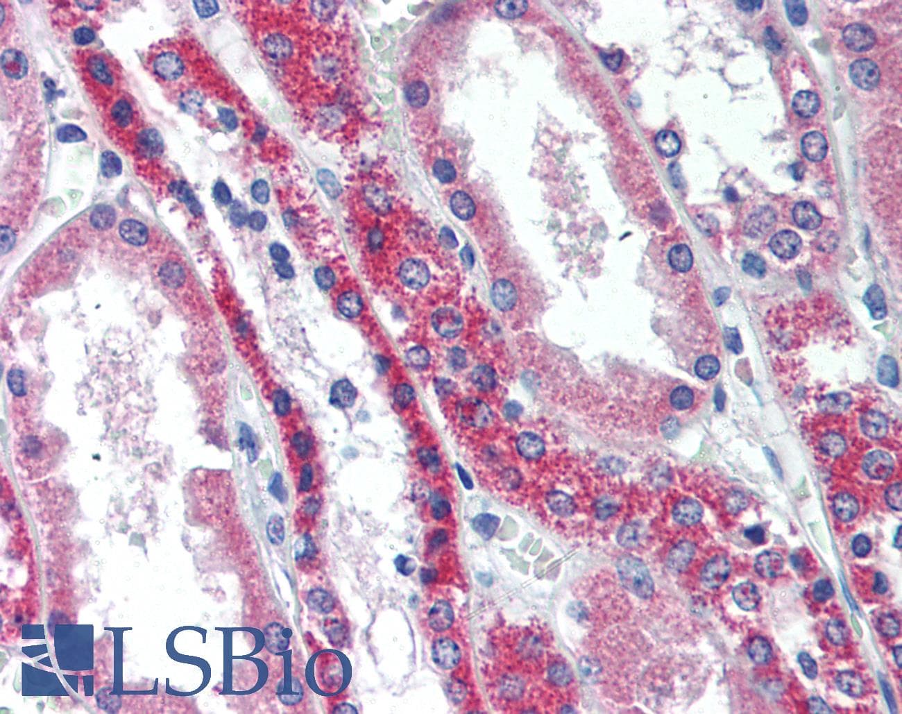 IHC-plus™ TNFRSF11A / RANK Antibody (aa603-613)