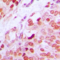 GATA1 Antibody (phospho-Ser142)