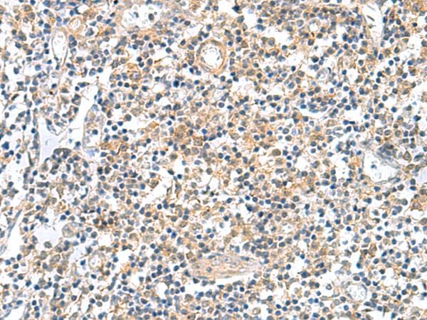 Polyclonal Rabbit anti-Human GEMIN7 Antibody (IHC)