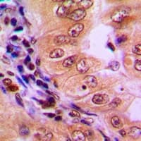 PRKAA1 / AMPK Alpha 1 Antibody (C-Terminus)
