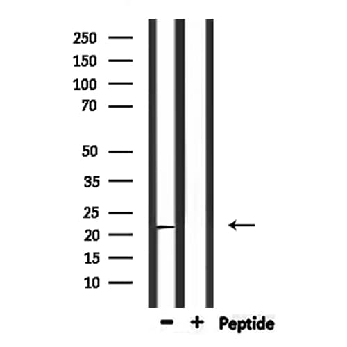 CYB561D2 Antibody