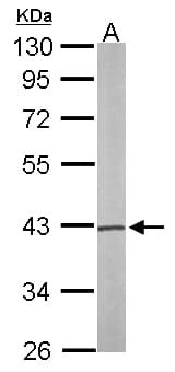 IHC-plus™ Polyclonal Rabbit anti-Human PSAT1 Antibody (aa48-328, IHC, WB)