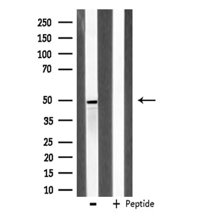 ADRA2A Antibody