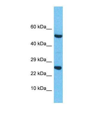 TC21 / RRAS2 Antibody (C-Terminus)