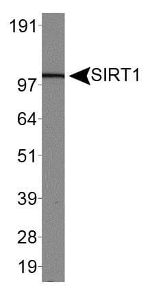 SIRT1 / Sirtuin 1 Antibody