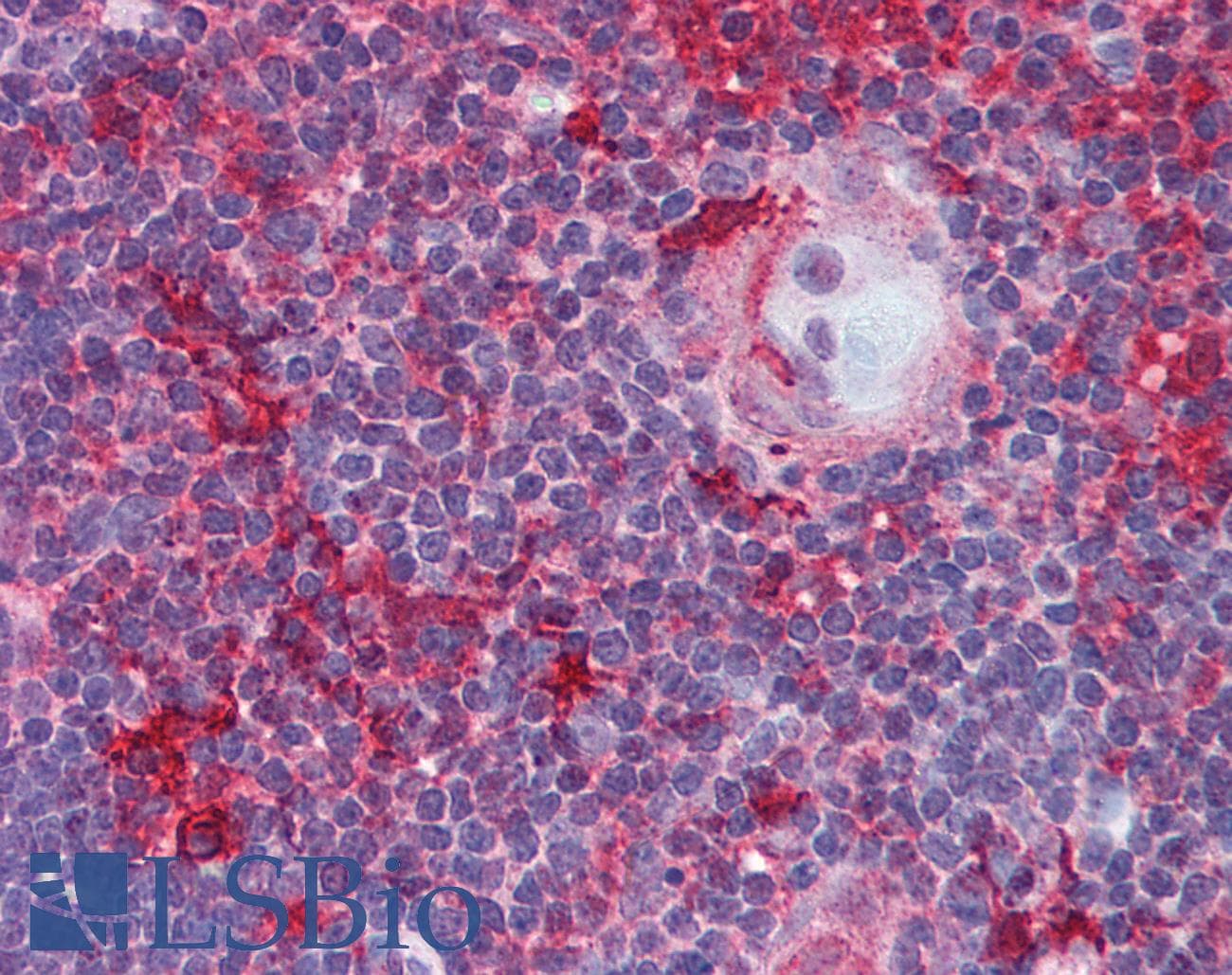 IHC-plus™ p56lck / LCK Antibody (clone 33D196)