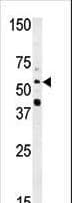 NMT2 Antibody (aa16-46)