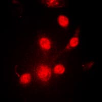 PR / Progesterone Receptor Antibody (phospho-Ser190)