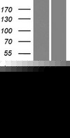 Human FABP12 Protein (Over-Expression Lysate Myc-DDK (Flag))