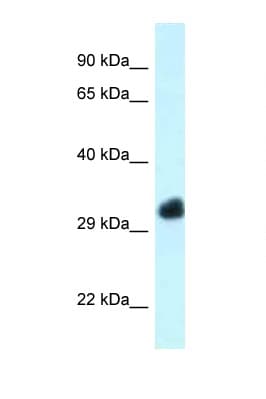 FBXO22 Antibody (aa190-239)