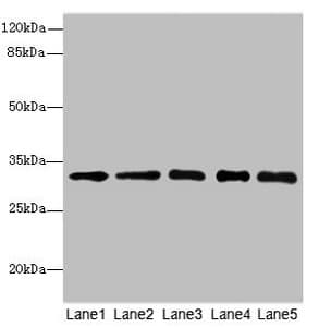 Polyclonal Rabbit anti-Human SGCD / Delta-Sarcoglycan Antibody (IHC, WB)