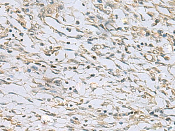 RAB3IP / RABIN3 Antibody