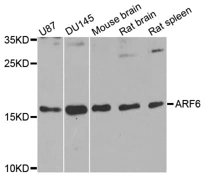 Polyclonal Rabbit anti-Human ARF6 Antibody (IHC, WB)