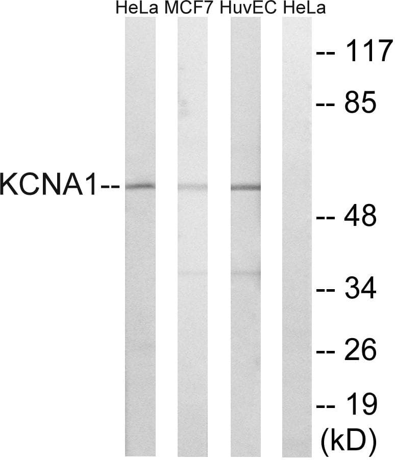 Polyclonal Rabbit anti-Human KCNA1 / Kv1.1 Antibody (WB)