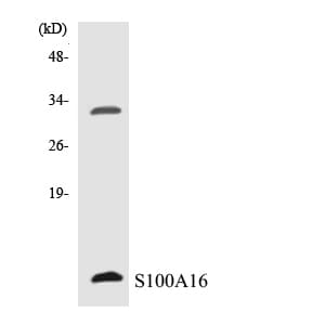 IHC-plus™ S100A16 Antibody (aa1-50)