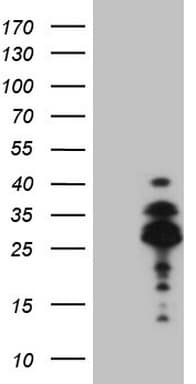 Monoclonal Mouse anti-Human BP1 / DLX4 Antibody (clone OTI7C8, IHC, WB)
