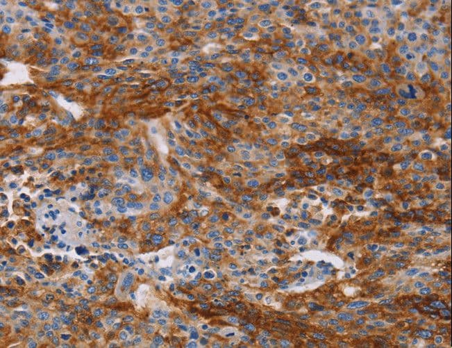 CA9 / Carbonic Anhydrase IX Antibody