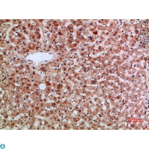 Polyclonal Rabbit anti-Human TMPO / TP / Thymopoietin Antibody (IF, WB)