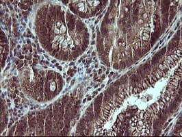 Placental Lactogen Antibody (clone OTI2G4)