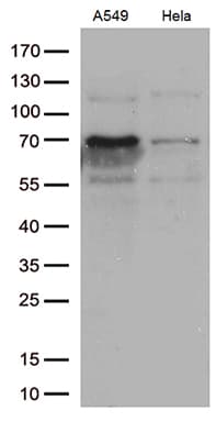 Monoclonal Mouse anti-Human ZKSCAN1 / ZNF36 Antibody (clone OTI2C9, IHC, WB)