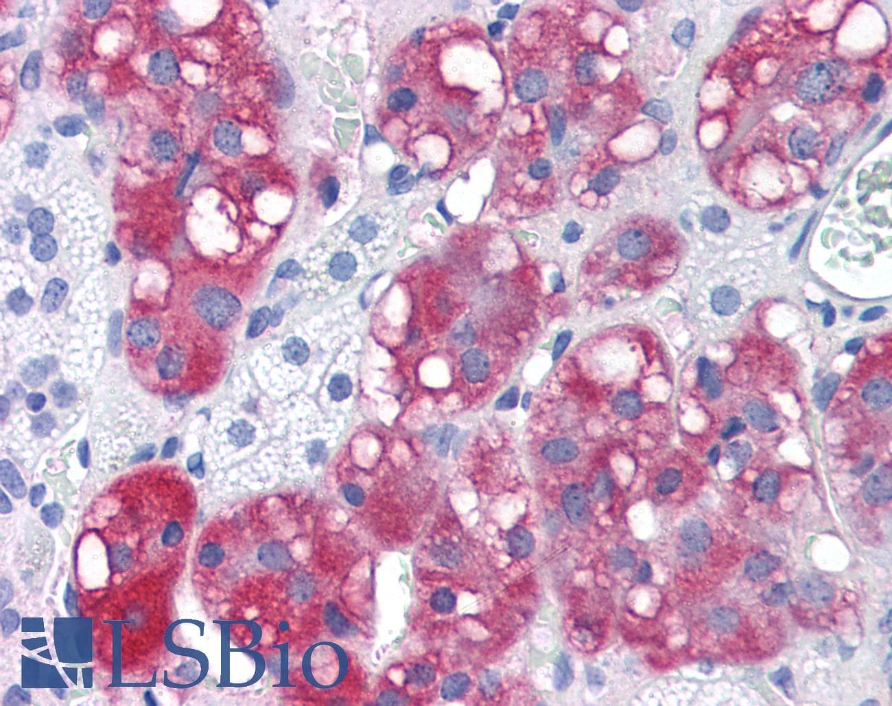 IHC-plus™ C4.4A / LYPD3 Antibody (C-Terminus)
