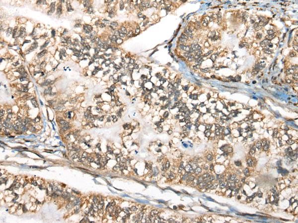BLNK Antibody