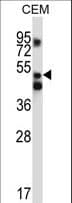 XPNPEP3 Antibody (aa440-469)