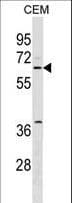 Polyclonal Rabbit anti-Human SPATS2L Antibody (aa55-83, WB)