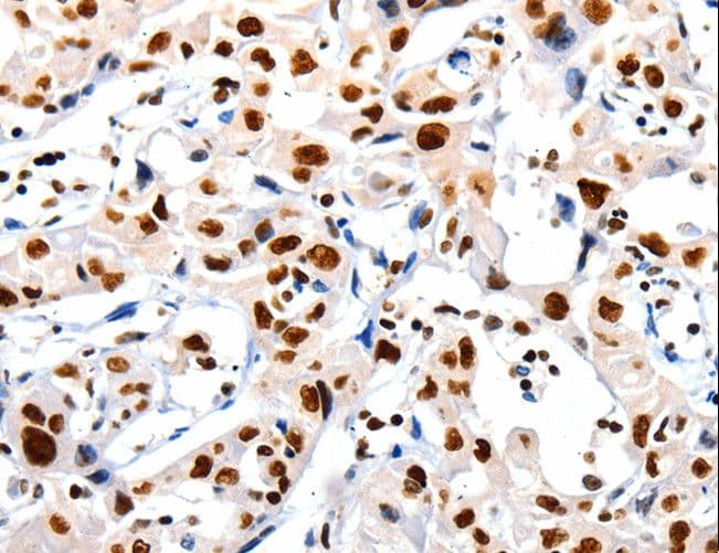 HDAC1 Antibody