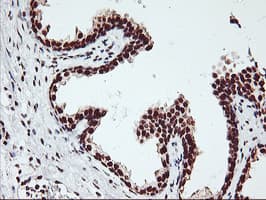 GSTT2 Antibody (clone OTI6C4)