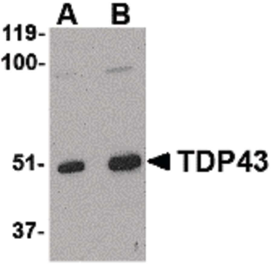 IHC-plus™ TDP-43 / TARDBP Antibody