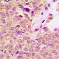 IRS1 Antibody (Internal)