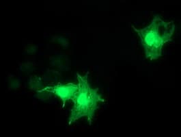 Monoclonal Mouse anti-Human RASD2 Antibody (clone OTI2G8, IF, WB)
