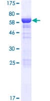 Human ASZ1 / Orf3 Protein (Recombinant GST)