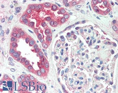 IHC-plus™ Monoclonal Mouse anti-Human IST1 Antibody (IHC, WB)