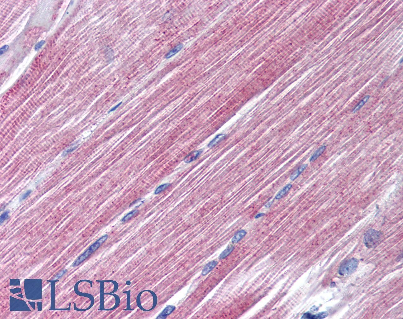 IHC-plus™ Polyclonal Rabbit anti-Human RAB7A / RAB7 Antibody (aa90-140, IHC, WB)