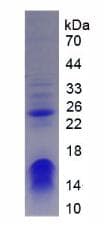 Human CHD3 Protein (Recombinant His, N-Terminal)