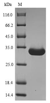 Mouse Angiogenin / ANG Protein (Recombinant 6His-SUMO, N-terminus)