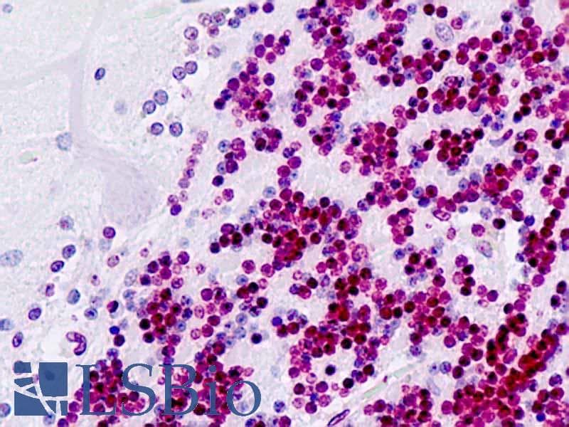 IHC-plus™ Polyclonal Rabbit anti-Human PDX1 Antibody (aa27-76, IHC, WB)