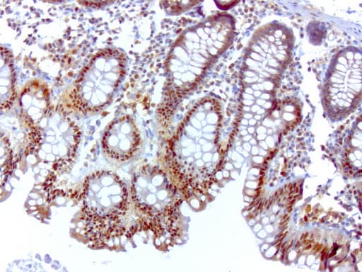 SQSTM1 Antibody (clone UMAB13, Carrier-free)