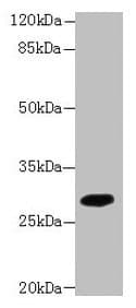 TMEM55A Antibody