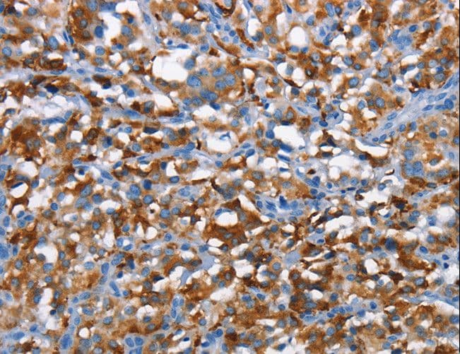 Polyclonal Rabbit anti-Human DNAM-1 / CD226 Antibody (IHC)