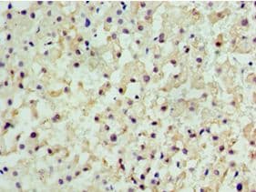 Polyclonal Rabbit anti-Human CENPQ Antibody (aa131-268, IHC)